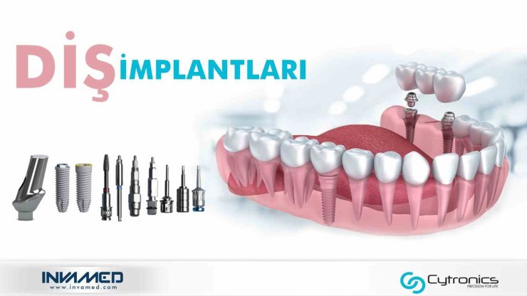 Türkiye’nin dünya çapında tanıttığı yenilik: INVAMED diş implantları